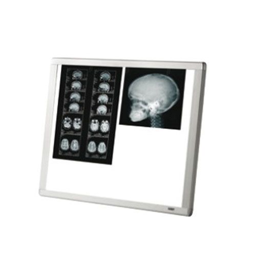 Negatoscópio LED Corpo Duplo